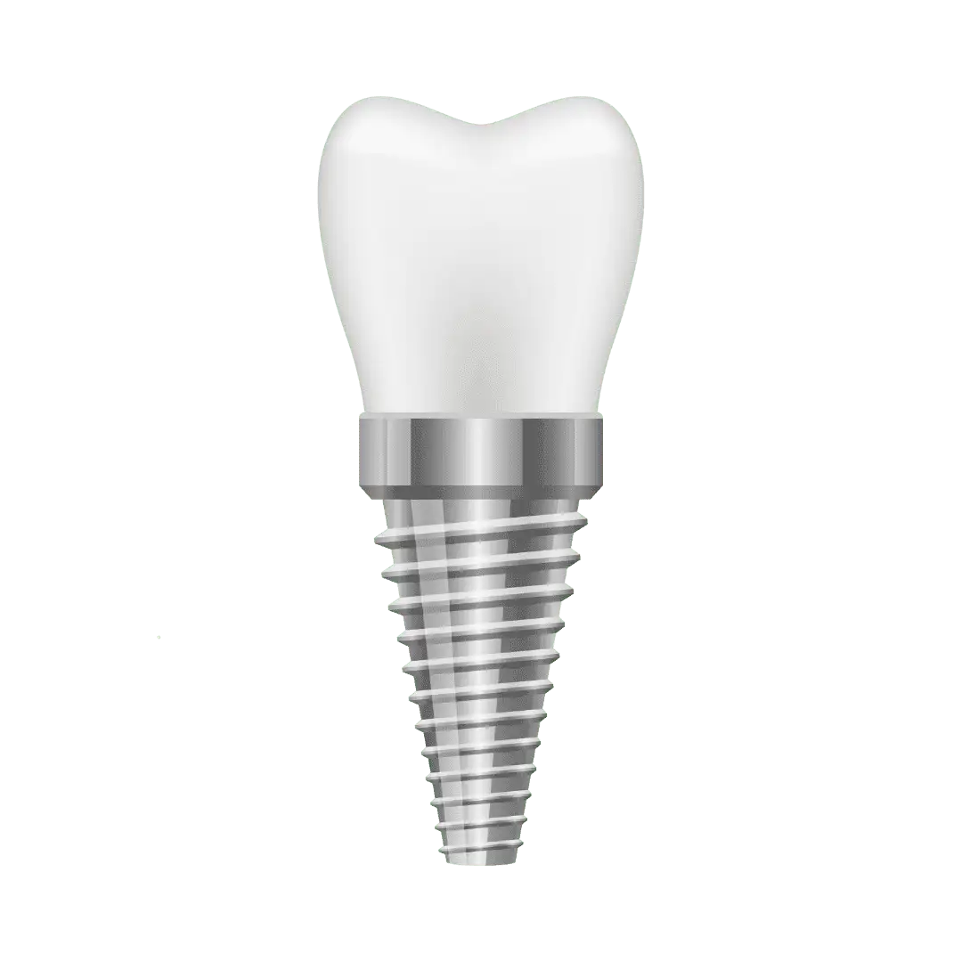 Single Implants