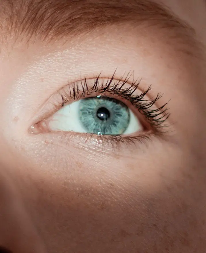 Tear Trough Filler at Stunning Skin Clinic, Ealing