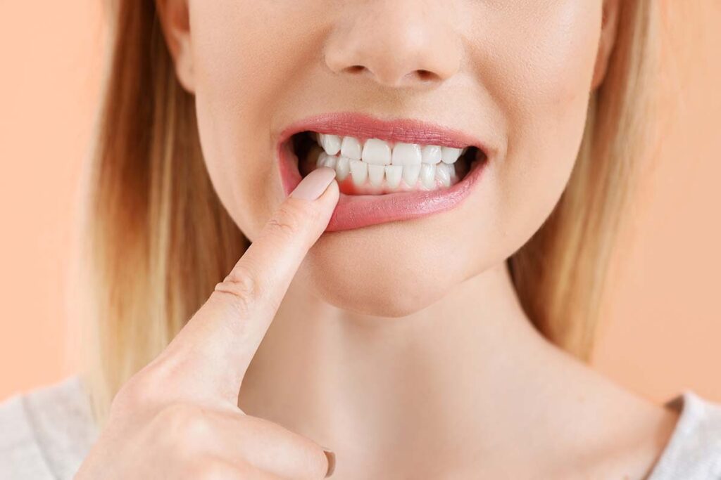 Gum Disease Treatments in west ealing
