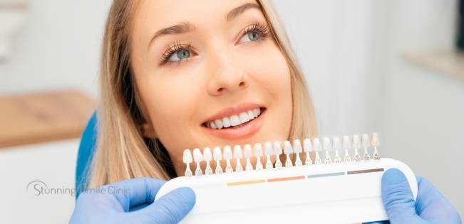 Close-up of a patient with dental veneers in Ealing, showcasing a bright and natural-looking smile.