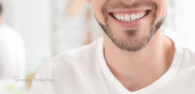 Yellow teeth before and after professional teeth whitening in Ealing.