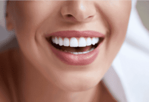 Woman smiling after safe teeth whitening in Ealing at Stunning Smile Clinic 