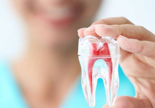 Root canal treatment in Tunbridge Wells