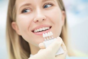 dental-veneers-and-dental-laminates-1904