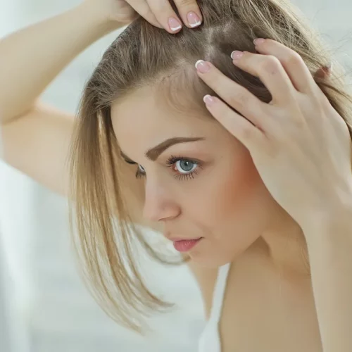 AnteAge Hair loss treatment